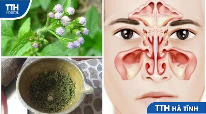 Cây hoa cứt lợn chữa viêm xoang - Bệnh viện đa khoa TTH Hà Tĩnh